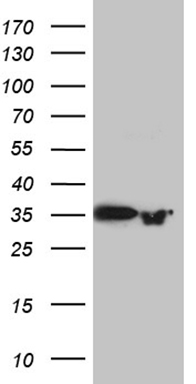 PGAM4 Antibody