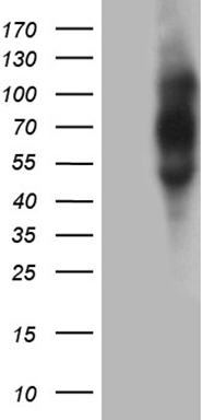 PGAM4 antibody