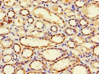 PGAP2 Antibody