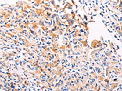 PGBD1 Antibody