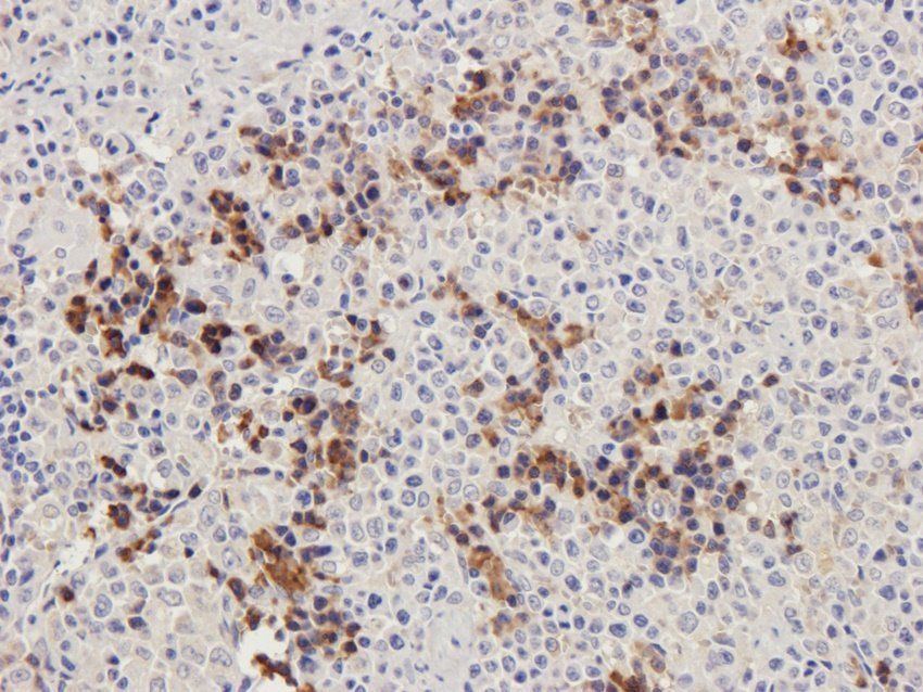 PGBD5 antibody