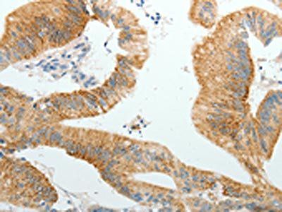 PGBD5 antibody