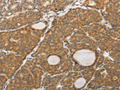 PGBD5 Antibody