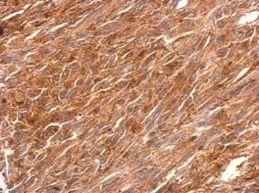 PGCP antibody