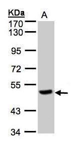 PGCP Rabbit Polyclonal Antibody