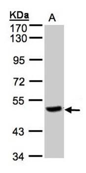 PGCP antibody