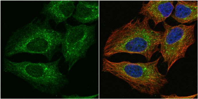 PGD antibody [N1N3]