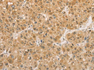 PGK2 Antibody