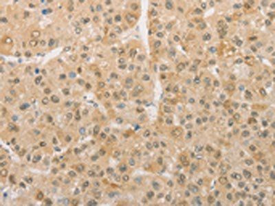 PGK2 Antibody