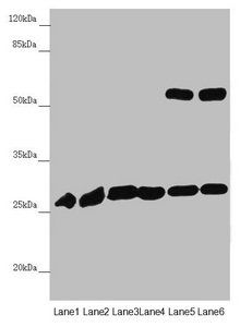 PGLS Antibody