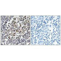 PGLS Antibody
