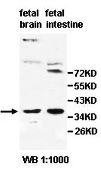 PGLYRP3 antibody