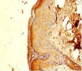PGLYRP4 Antibody