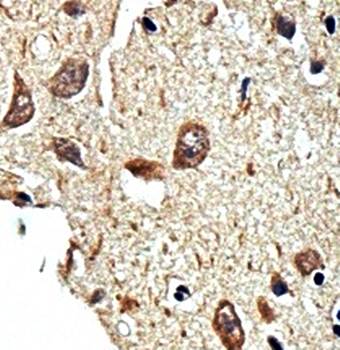 PGM2 Rabbit Polyclonal Antibody