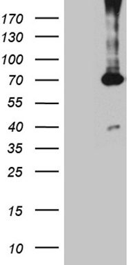 PGM2L1 antibody