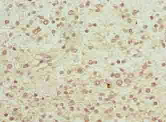 PGM2L1 Antibody