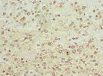 PGM2L1 antibody