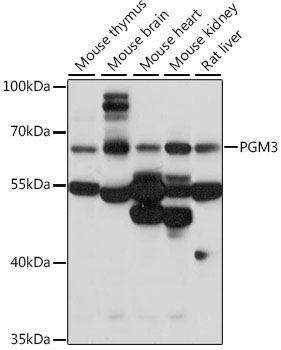 PGM3 antibody