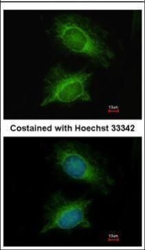 PGM3 antibody [N1C1]