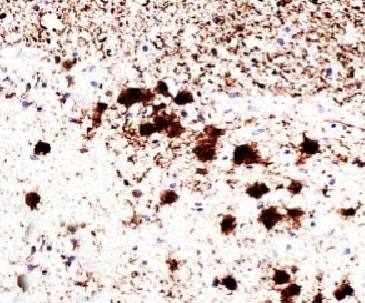 PGP9.5 / UchL1 (pan-Neuronal Marker) Antibody