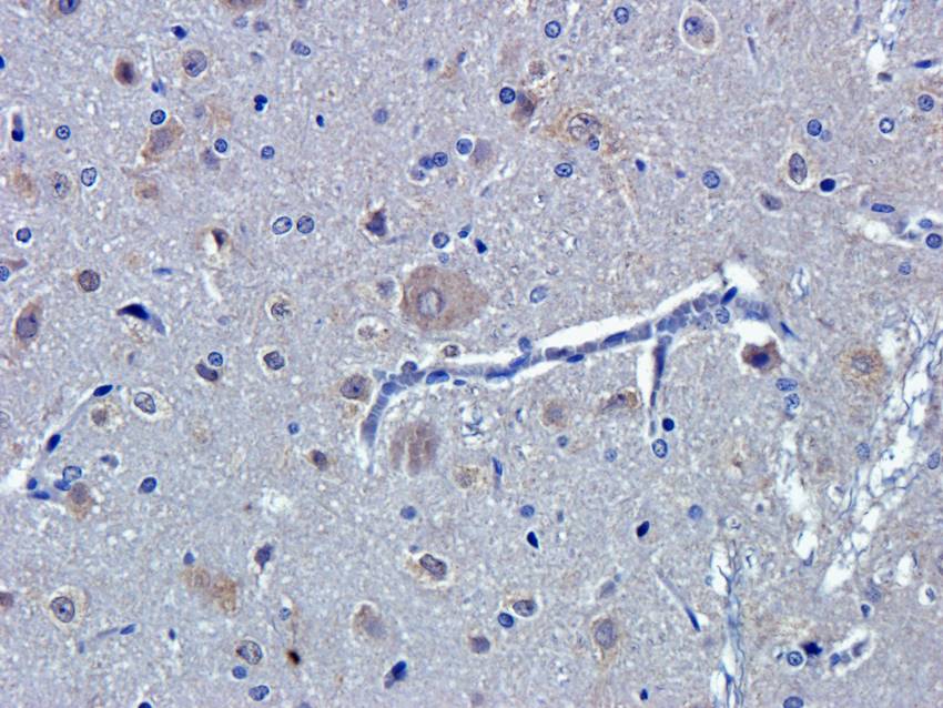 PGP9.5 Rabbit Polyclonal Antibody