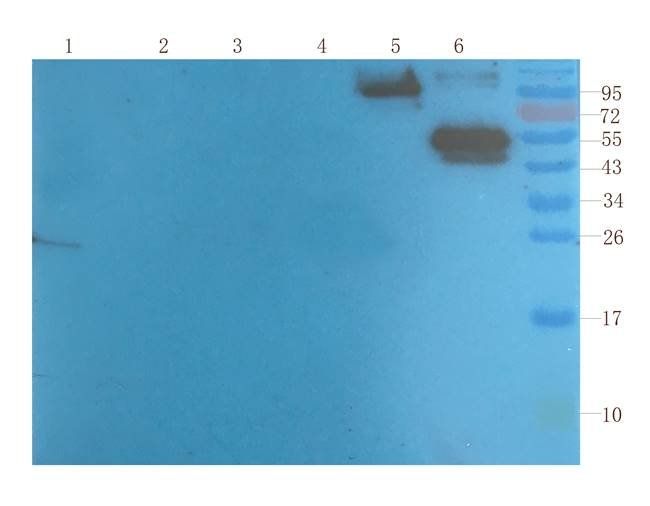 PGP9.5 Rabbit Polyclonal Antibody