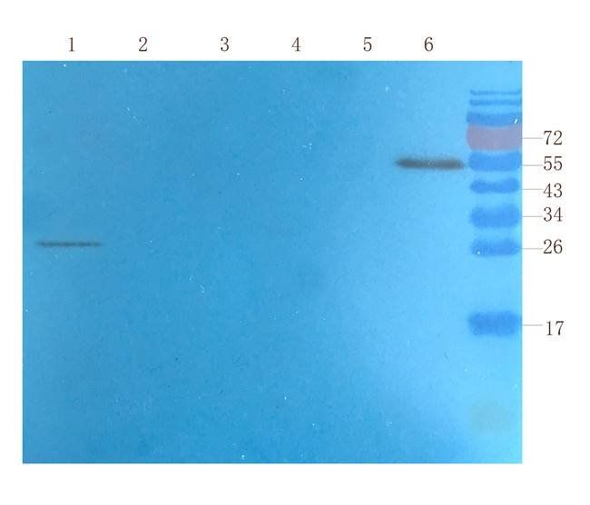 PGP9.5 antibody