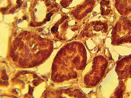 Rabbit anti Human PH domain leucine-rich repeat-containing protein phosphatase 2