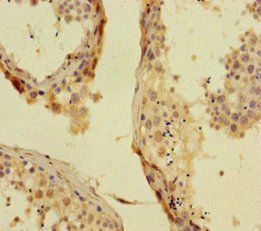 PHC1 Antibody