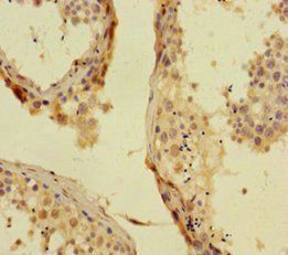 PHC1 antibody