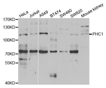 PHC1 antibody