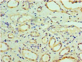 FARSA Antibody