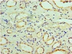 Phenylalanine-tRNA ligase alpha subunit antibody