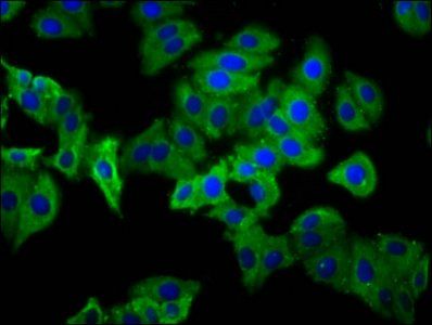 PHEX Antibody