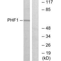 PHF1 antibody