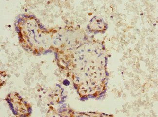 PHF11 Antibody