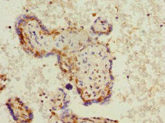 PHF11 antibody