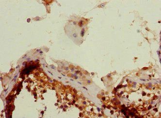 PHF11 Antibody