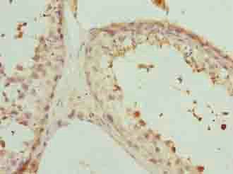PHF13 Antibody