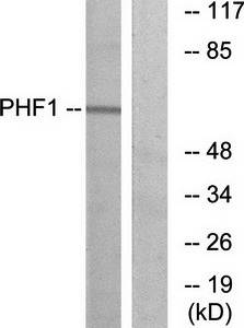 PHF1 antibody