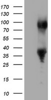 PHF21B Antibody