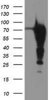 PHF21B Antibody