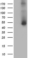 PHF21B antibody