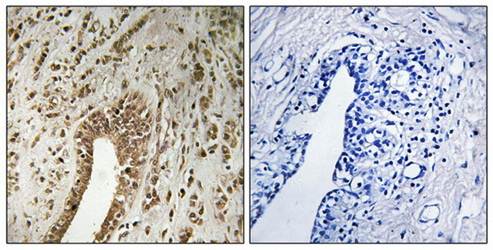PHF3 Antibody