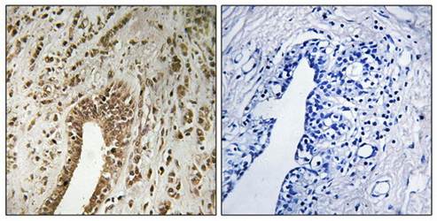 PHF3 antibody