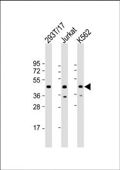 PHF6 antibody