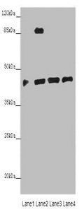 PHF6 antibody