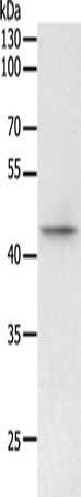 PHF6 antibody