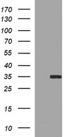 PHF7 Antibody