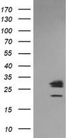 PHF7 Antibody